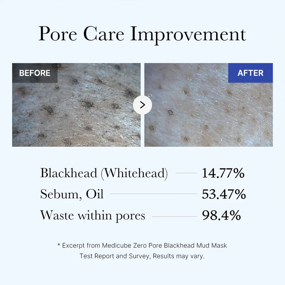 Medicube - Zero Pore Blackhead Mud Mask